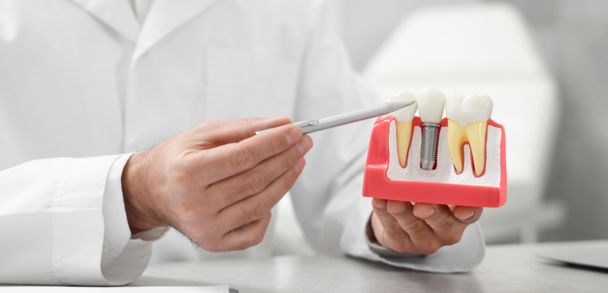 Know if Gums Grow Back After Implants - Media Hometown Dental