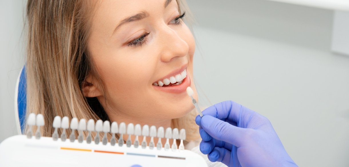 discover the benefits of veneers for smile makeovers